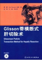 Glisson 蒂横断式肝切除木