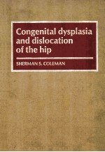 Congenital dysplasia and dislocation of the hip