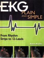 EKG Plain and Simple: From Rhythm Strips to 12-Leads