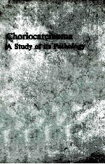 Choriocarcinoma a study of its pathology