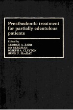 Prosthodontic treatment for partially edentulous patients