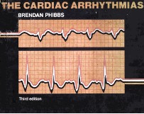 The cardiac arrhythmias