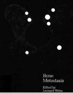 Bone Metastasis