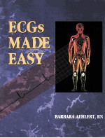 ECGs made easy