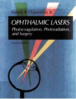 Ophthalmic Lasers