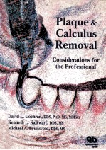 Plaque and calculus removal : considerations for the professional