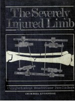 The severely injured limb.