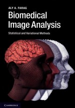 BIOMEDICAL IMAGE ANALYSIS  STATISTICAL AND VARIATIONAL METHODS