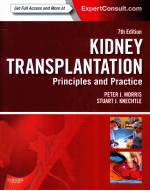 KIDNEY TRANSPLANTATION:PRINCIPLES AND PRACTICE SEVENTH EDITION