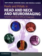 PEARLS AND PITFALLS IN HEAD AND NECK AND NEUROIMAGING  VARIANTS AND OTHER DIFFICULT DIAGNOSES