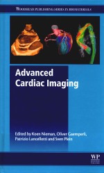 Advanced Cardiac Imaging