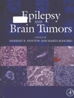 Epilepsy and brain tumors