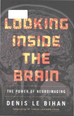 Looking inside the brain the power of neuroimaging