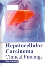 Hepatocellular carcinoma clinical findings