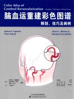 脑血运重建彩色图谱 解剖、技巧及病例