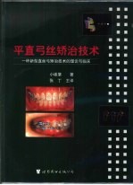 平直弓丝矫治技术 一种新型直丝弓矫治技术的理论与临床