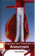 DIAGNOSIS AND TREATMENT OF ANEURYSM