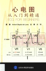 心电图从入门到精通