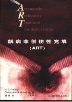 龋病非创伤性充填 ART