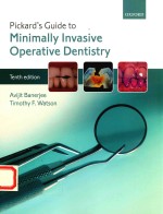 PICKARD'S GUIDE TO MINIMAIIY INVASIVE OPERATIVE DENTISRY