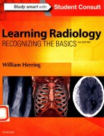 LEARNING RADIOIOGY RECOGNIZING THE BASICS