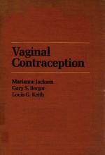 VAGINAL CONRTACEPTION