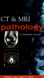 CT & MRI PATHOLOGY A POCKET ATLAS