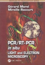 PCR RT PCR IN SITU LIGHT AND ELECTRON MICROSCOPY