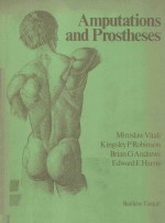 AMPUTATIONS AND PROSTHESES