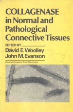 COLLAGENASE IN NORMAL AND PATHOLOGICAL CONNECTIVE TISSUES