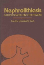 NEPHROLITHIASIS PATHOGENESIS AND TREATMENT