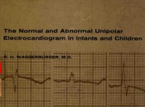 THE NORMAL AND ABNORMAL UNIPOLAR ELECTROCARDIOGRAM IN INFANTS ACTIVATION TIMES