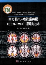 同步脑电 功能磁共振（EEG-fMRI）原理与技术