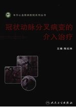 冠状动脉分叉病变的介入治疗