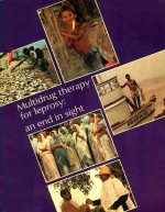 MULTIDRUG THERAPY FOR LEPROSY AN END IN SIGHT