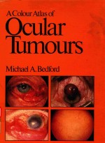 A%COLOUR ATLAS OF OCULAR TUMOURS