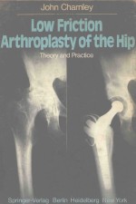 LOW FRICTION ARTHROPLASTY OF THE HIP THEORY AND PRACTICE