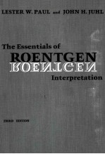 The essentials of roentgen interpretation