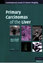 Primary Carcinomas of the Liver