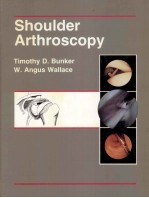 SHOULDER ARTHROSCOPY