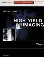 HIGH-YIELD IMAGING CHEST