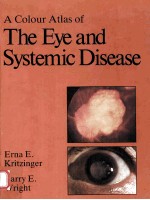 colour atlas of the eye and systemic disease