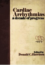 Cardiac arrhythmias