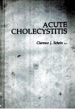 ACUTE CHOLECYSTITS