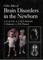 Color atlas of brain disorders in the newborn