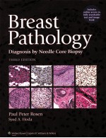 BREAST PATHOLOGY DIAGNOSIS BY NEEDLE CORE BIOPSY THIRD EDITION