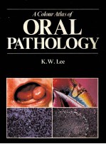 A colour atlas of oral pathology