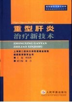 重型肝炎治疗新技术