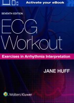 ECG WORKOUT EXERCISES IN ARRHYTHMIA INTERPRETATION SEVENTH EDITION