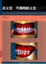 总义齿和可摘局部义齿的设计  上